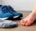 What Causes Toe Hotspots When Running? Stop Them